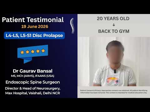 Double Slip Disc (L4-L5 & L5-S1) | Recovery After UBE Spine Surgery