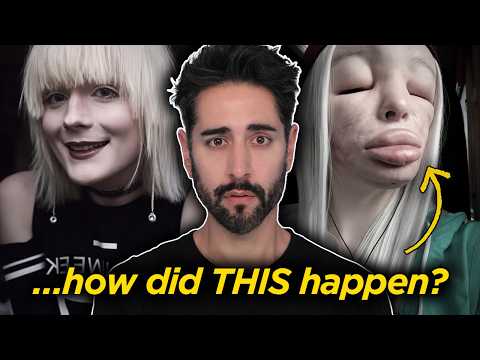 What Happened To Elva? The Hidden Crisis Behind DIY Fillers