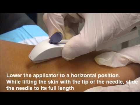 Implanon NXT insertion june 2011.wmv