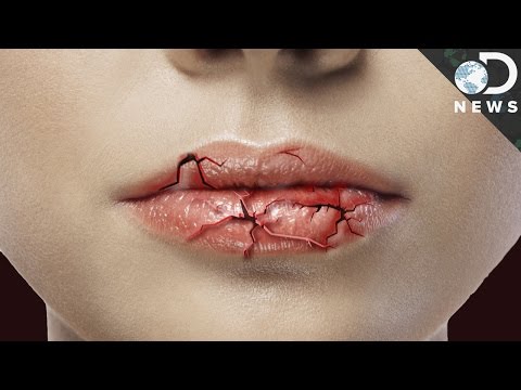 【生活百科】為什麼天氣冷,嘴唇就容易乾裂破皮?(中英字幕)(Why Do Your Lips Get Chapped?)
