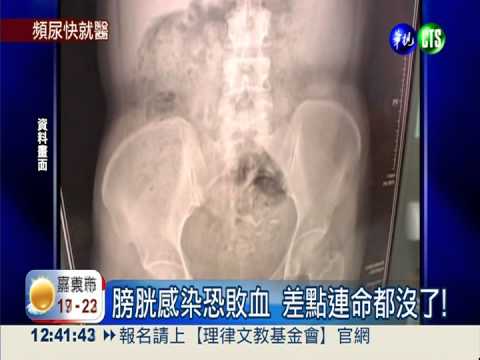 憋尿致膀胱感染 1天如廁逾20次!