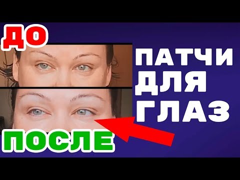 Гидрогелевые патчи для глаз Experalta Platinum. Сравните ДО - ПОСЛЕ применения!