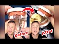 Instant Fake Teeth In SECONDS?! Orthodontist Reacts