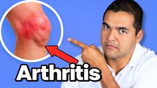 How to Slow Knee Arthritis Before It Gets Worse