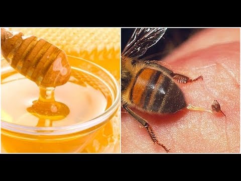 , title : 'Hãy nhớ 4 cách khử độc tại chỗ khi bị ong đốt, nó sẽ cứu bạn trước bác sĩ đấy-NTM'