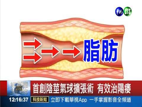 首創氣球擴張術 男人重拾"性"福