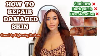 HOW TO REPAIR DAMAGED SKIN CAUSED BY SKIN LIGHTENING PRODUCTS. (discoloration, thin skin ,sunburn)