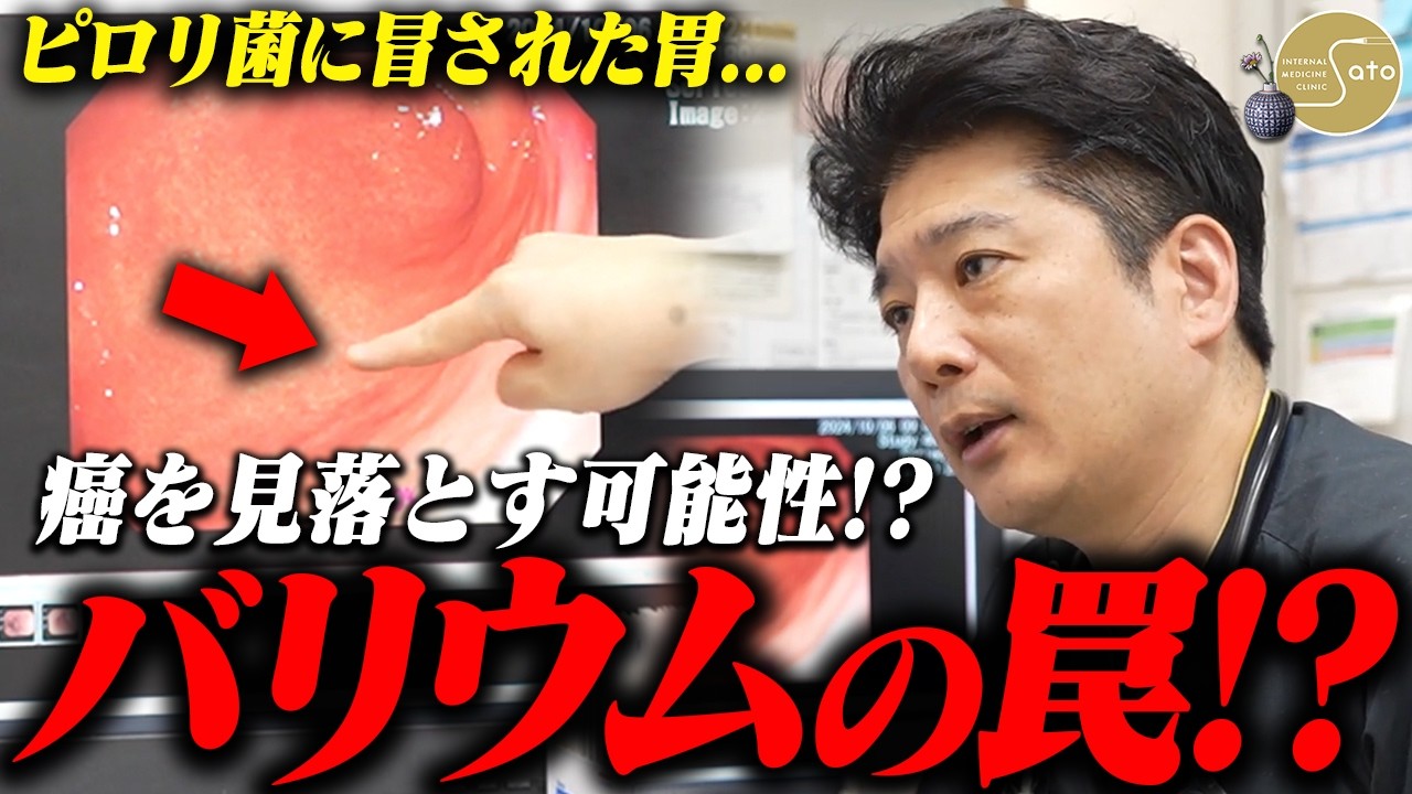 『バリウム検査は時代遅れ！？』ピロリ菌がいた胃は癌リスクが！？医師が患者に語った胃カメラ検査の有用性！