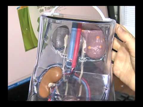 Transplante que não Aconteceu - Jornal do SBT Brasília 08/07/2011