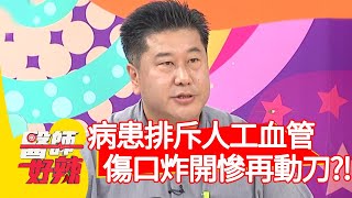 洗腎病患排斥人工血管，傷口炸開慘2次動刀？！【醫師好辣】20200504 part3 EP938 蕭敦仁 張心妍