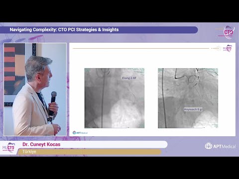 New toolkit for CTO and CHIP patients: Anyreach CTO wires and Elong MC - Dr. Cuneyt Kocas (Türkiye)
