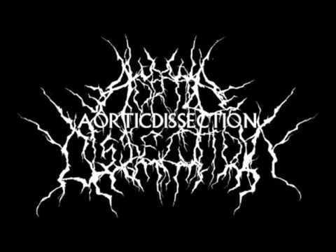 Aortic Dissection - Within This Cracked Earth (HD)
