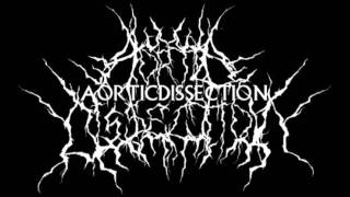Aortic Dissection - Within This Cracked Earth (HD)