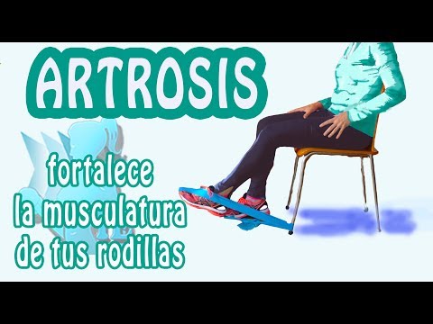 Artrosis de rodilla: qué es y cómo prevenirla