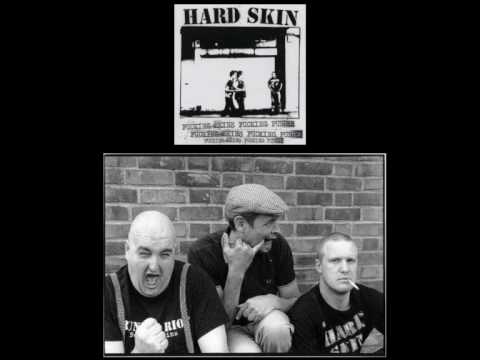 Hard Skin - We Are The Wankers