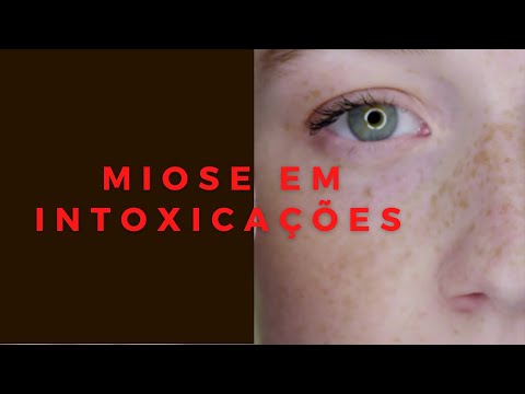 Método das pupilas #2 MIOSE em intoxicações