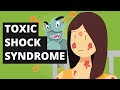 What is Toxic Shock Syndrome? (Tampons Disease)