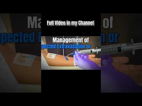 Extravasation Management of Vesicant and Irritant Drugs #shorts #extravasation #ivf
