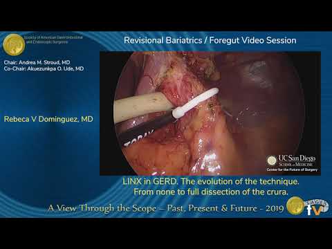 LINX in GERD. The Evolution of the Technique. From None to Full Dissection of the Crura