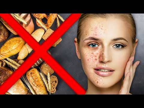 Hidden Dangers of Soy How Does it Affect Your Body – Dr Berg