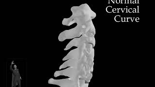 Normal Cervical Curve