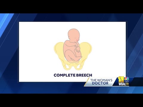 Can a 'breech' baby correct itself before birth?