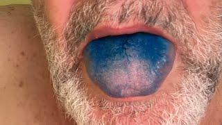 Methylene blue no Blue tongue how to take