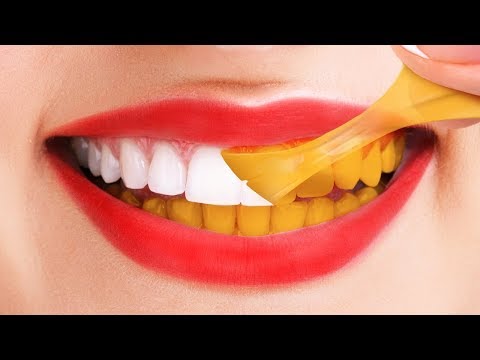 download lagu mp3 mp4 Tips Voor Wittere Tanden, download lagu Tips Voor Wittere Tanden gratis, unduh video klip Tips Voor Wittere Tanden