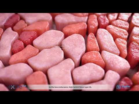 eXciteOSA 3D Medical Video