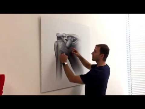 Funktionelle Anatomie der Schulter