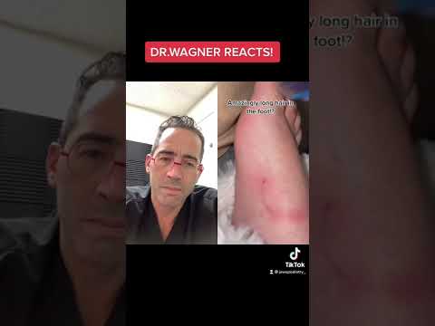 LONGEST INGROWN HAIR? 😳#shorts #ingrown #ingrownhair