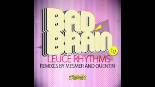 Leuce Rhythms - Bad Brain (Quentin's Good Liver Remix) - Scarcity Records