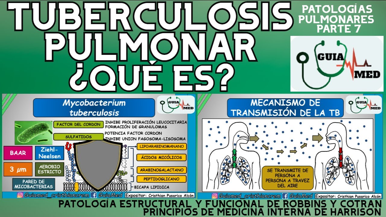 TUBERCULOSIS PULMONAR QUE ES  | GuiaMed