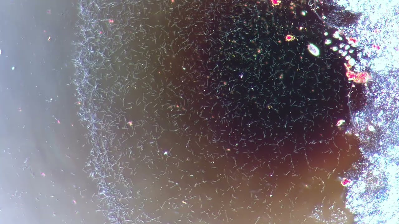 Bacteria and complex cells