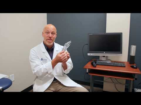 California Hand Specialist Dr. Joshua C. Richards Talks about Metacarpal Fracture