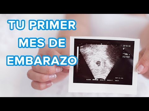 download lagu mp3 mp4 Embarazo, download mp3 Embarazo free download mp3, download mp3 Embarazo