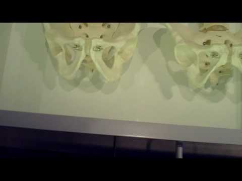 MARL-KANAL:20 Jahre Archäologie in Kalkriese: Knochenfunde