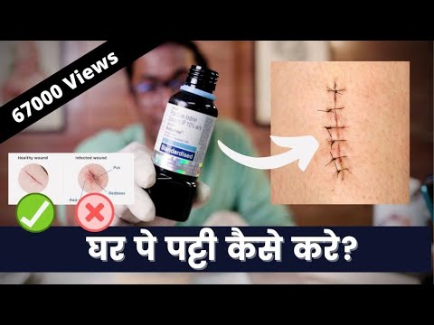 Dressing of Stitches At Home + Identify Unhealthy Stitches? | Dr. Vishal Tomar