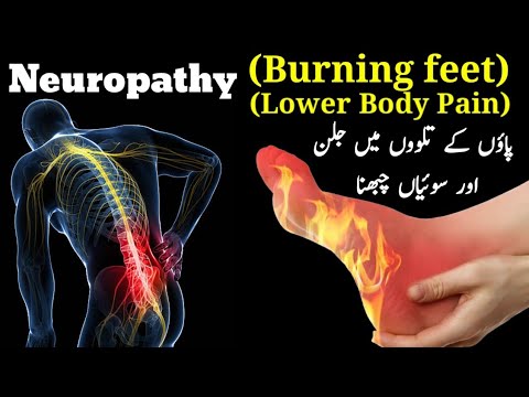 Peripheral neuropathic pain | Burning feet and Neuropathic pain causes and symptoms in Urdu/Hindi