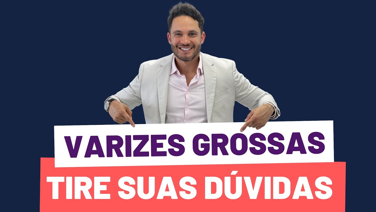 Varizes grossas: como evitar que elas te causem problemas!!