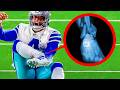 20 Most DANGEROUS Injuries In NFL
