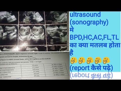 Anomaly sonography( ultrasound) मे BPD,HC,AC,FL,TL parameters का क्या मतलब होता है, report कैसे पढ़े