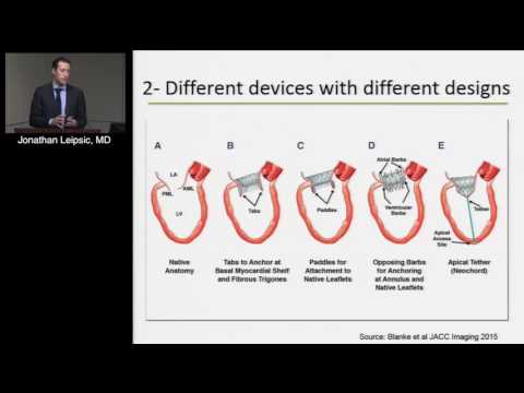 CT for Transcatheter Mitral and Tricuspid Interventions (Jonathan Leipsic, MD) March 16, 2017