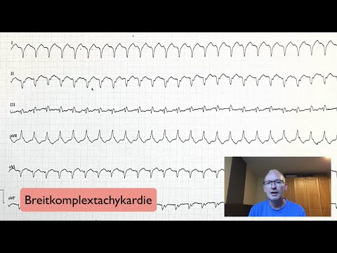 ECG Quickie: Wide Complex Tachycardia Tips and Tricks!