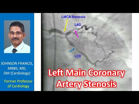 Left main coronary artery stenosis