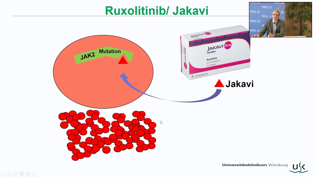 Neues bei der Behandlung Myeloproliferativen Neoplasie PV, ET, OMF und CML