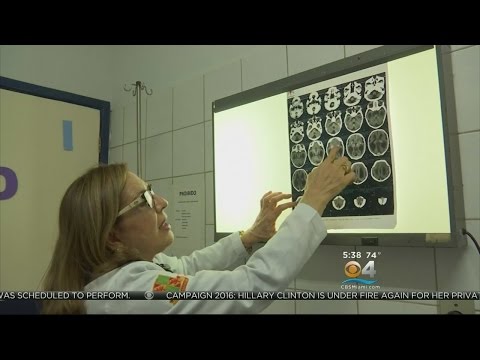 Healthwatch: New Study On Zika Virus Birth Defects