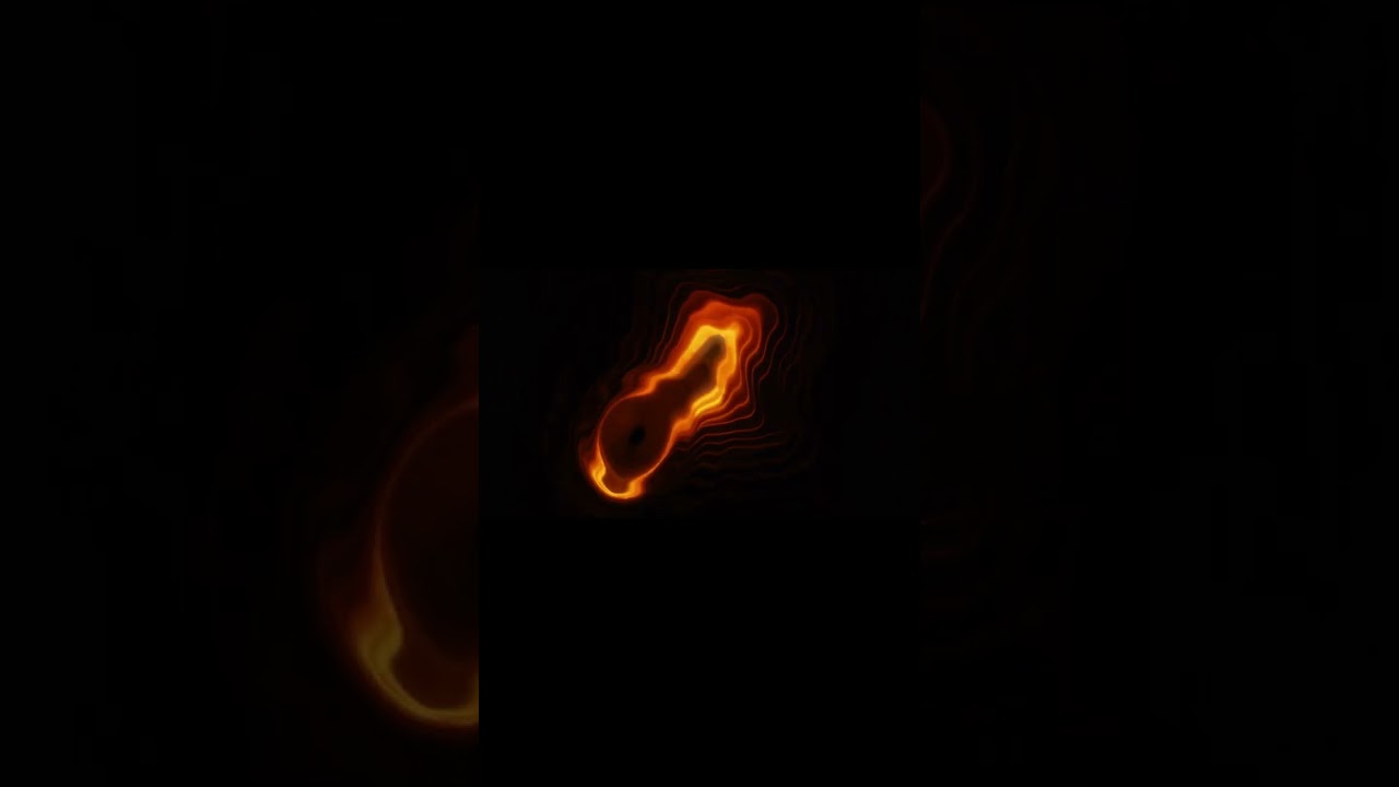 Magic Mushrooms and the Mind  Psilocybin’s Hyperconnected Brain State Linked to Therapeutic Effects