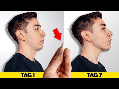 7 Tage durchgehend Kaugummi kauen & DAS passiert | Selbstexperiment