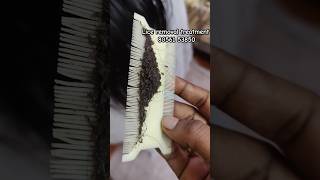 Lot of lice 😱 treatment 📍 Chennai &amp; at ur doorstep #headlicetreatment#lice#nits#headlice#haircare#